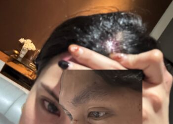 Kronologi Dugaan Penganiayaan Putri Pariwisata Asal Sulut oleh Oknum Pengacara di Kafe Jakarta