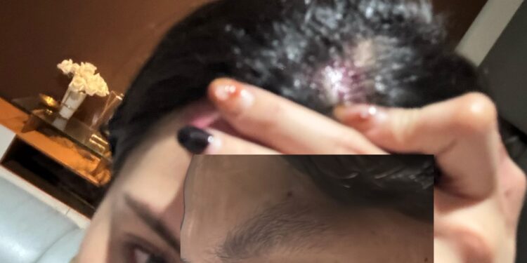 Kronologi Dugaan Penganiayaan Putri Pariwisata Asal Sulut oleh Oknum Pengacara di Kafe Jakarta