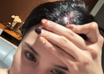 Putri Gona Nender bersama Temannya Diduga Dianiaya oleh Oknum Pengacara di Kafe Jakarta