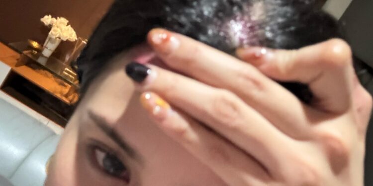 Putri Gona Nender bersama Temannya Diduga Dianiaya oleh Oknum Pengacara di Kafe Jakarta