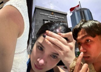 Putri Gona Nender Laporkan Oknum Pengacara ke Polda Metro Jaya, Buntut Dugaan Penganiayaan