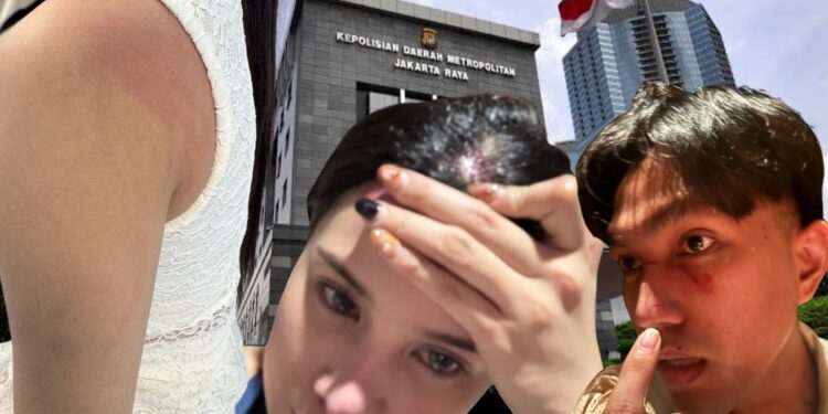 Putri Gona Nender Laporkan Oknum Pengacara ke Polda Metro Jaya, Buntut Dugaan Penganiayaan