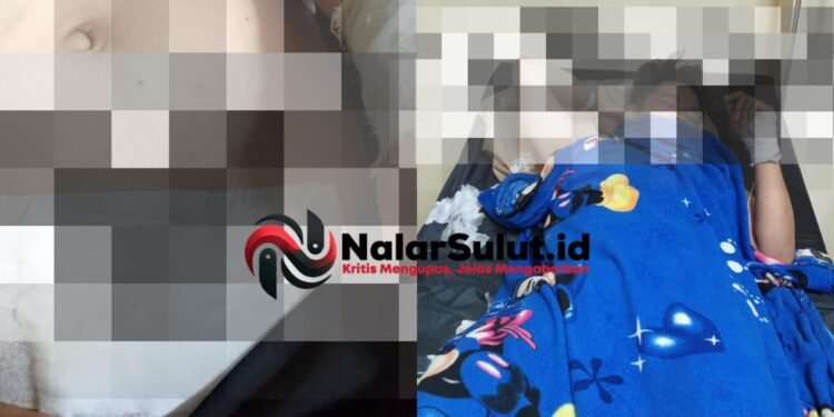 Sakit hingga Naik Meja Operasi, Karyawan PT Sumagud Keluhkan Sikap Perusahaan